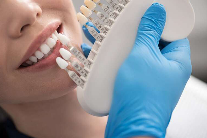 セルフホワイトニング